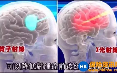 “质子疗法”已列入香港友邦保险理赔范围！
